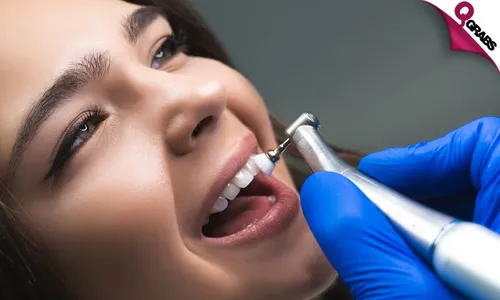 Teeth Scaling, Polishing, X-Ray & More!